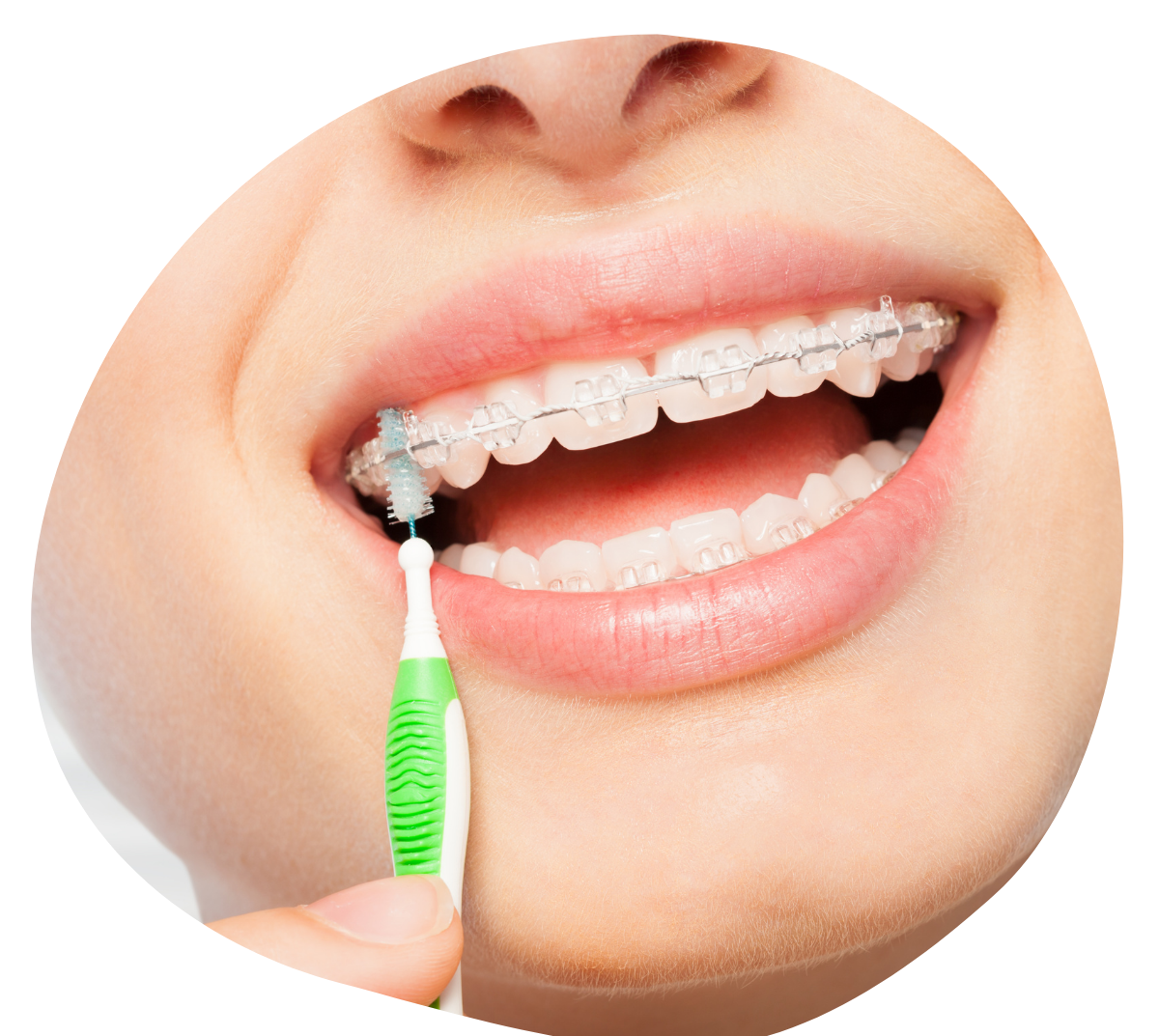 orto https://dogaldis.com.tr/wp-content/uploads/2022/01/orto.png