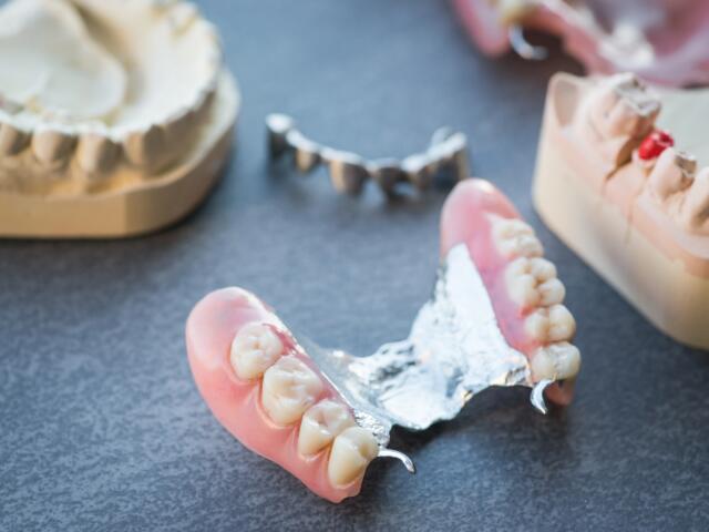 Artificial replacement teeth on a dark surface